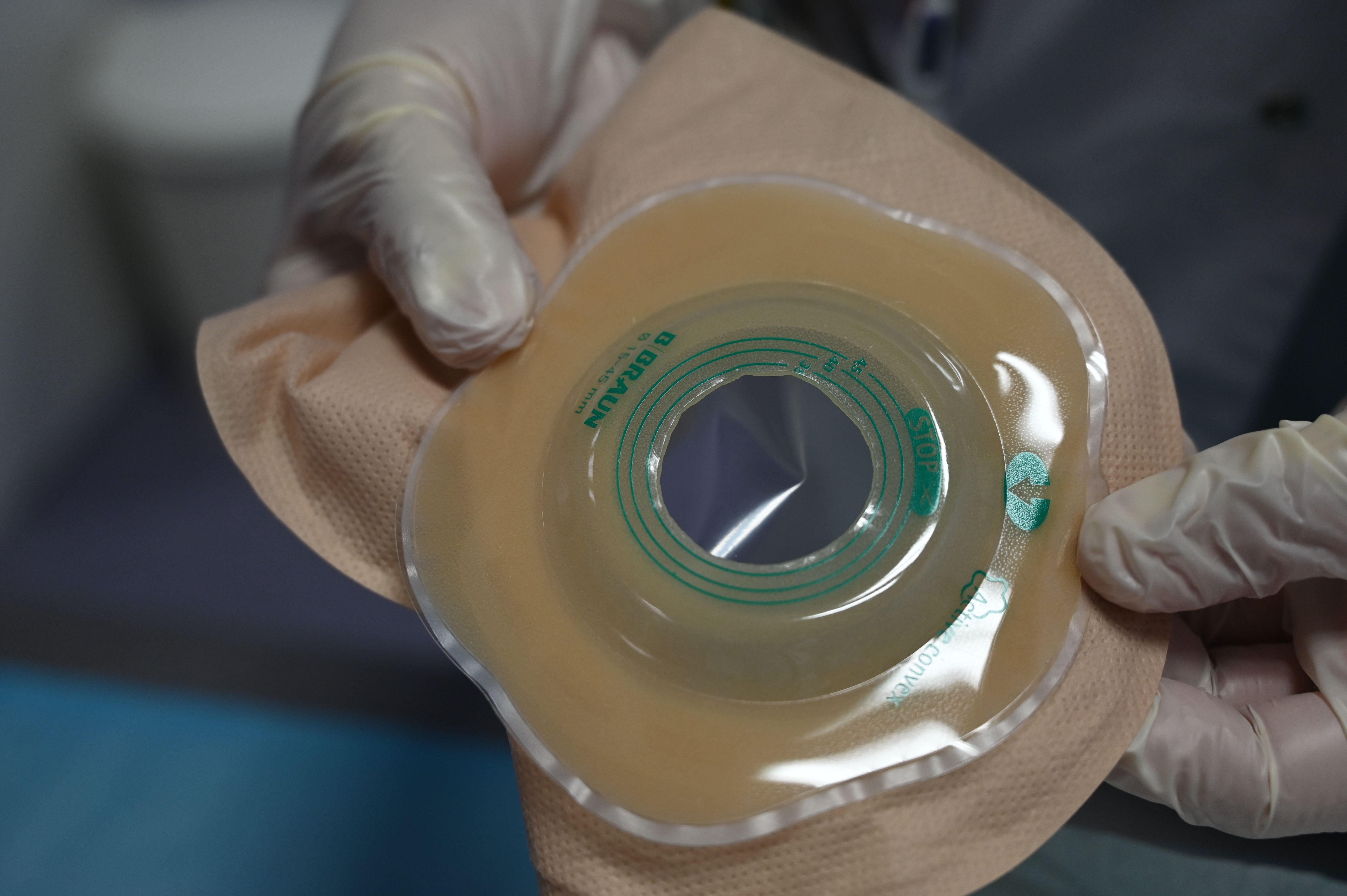 Types of Ostomies